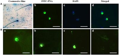 Expression, Localization of SUMO-1, and Analyses of Potential SUMOylated Proteins in Bubalus bubalis Spermatozoa